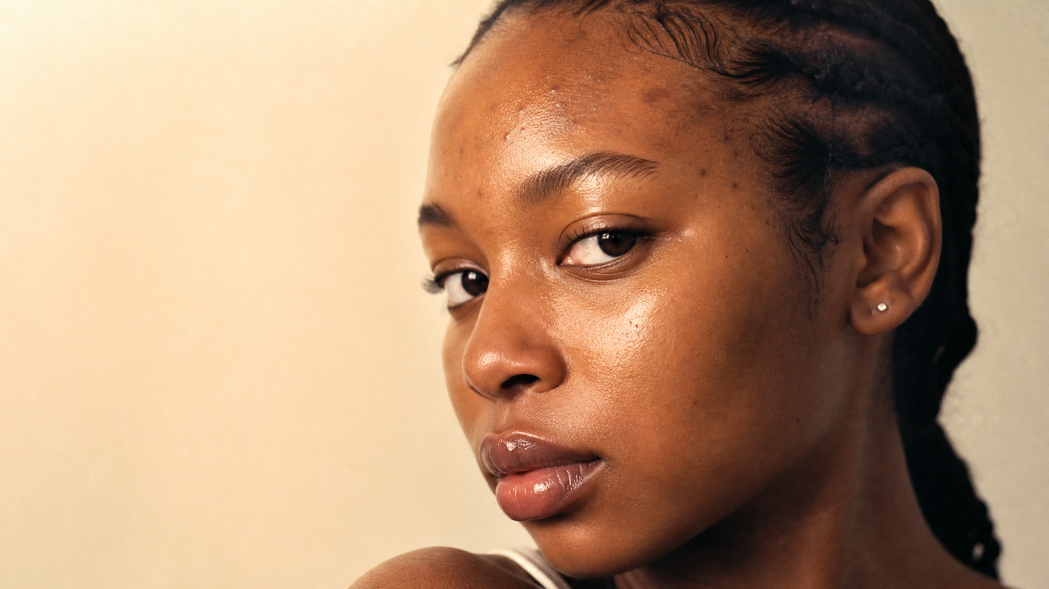 SKIN DEEP 7: Is Your Haircare Breaking Out Your Skin?