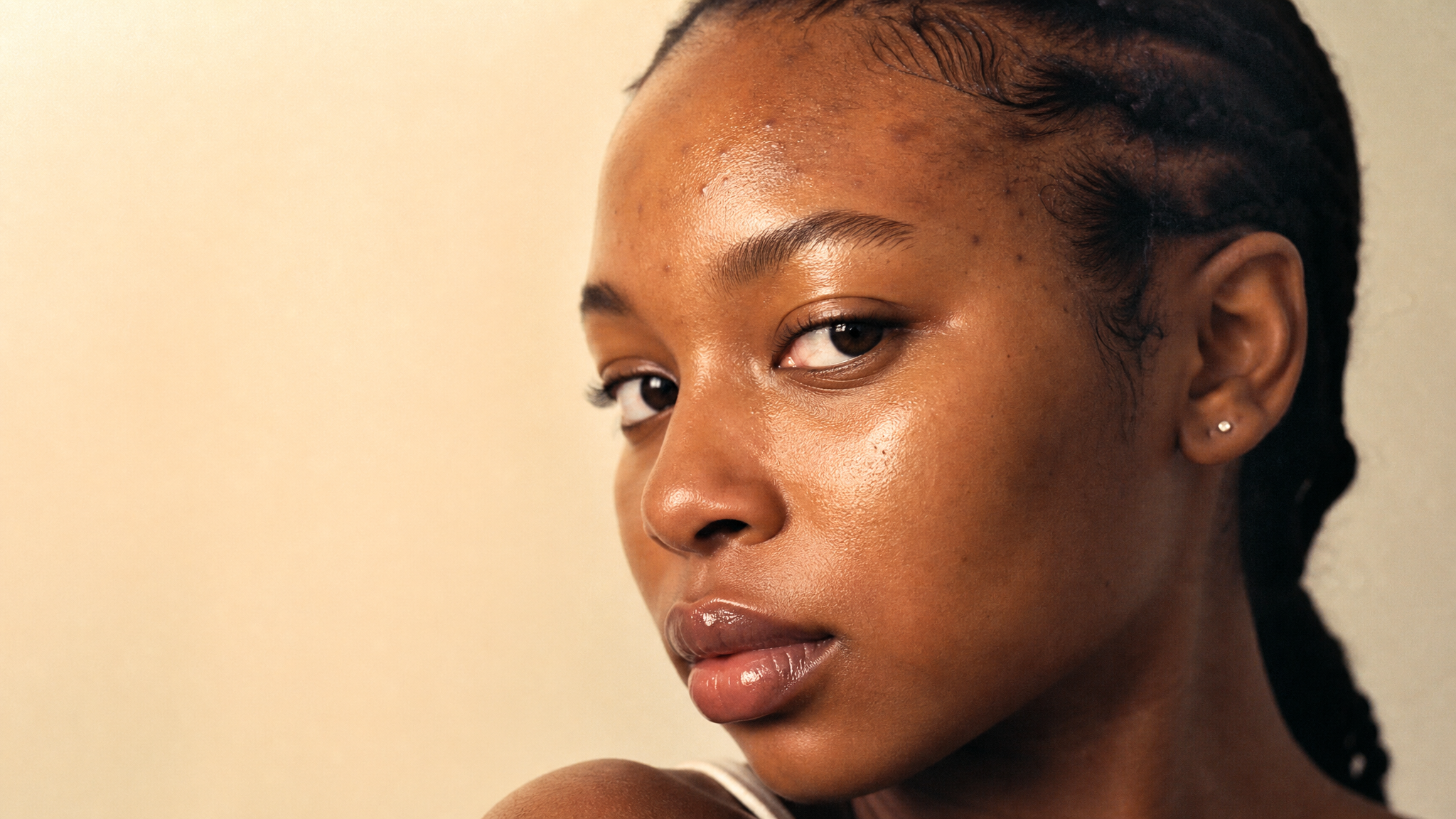 SKIN DEEP 7: Is Your Haircare Breaking Out Your Skin?